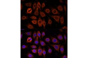 Immunofluorescence analysis of L929 cells using TMEM11 antibody (ABIN7270952) at dilution of 1:100. (TMEM11 anticorps  (AA 1-80))