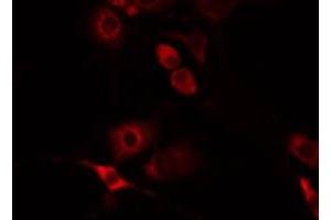 ABIN6275993 staining Hela by IF/ICC. (FZD8 anticorps  (N-Term))