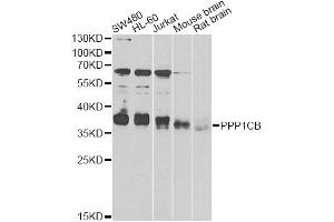 Western blot analysis of extracts of various cell lines, using PPP1CB antibody (ABIN6290761) at 1:1000 dilution. (PPP1CB anticorps)