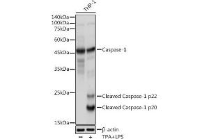 Immunohistochemistry of paraffin-embedded human colon using Caspase-1 Rabbit pAb (ABIN3021170, ABIN3021171, ABIN3021172 and ABIN6214049) at dilution of 1:100 (40x lens). (Caspase 1 anticorps  (AA 1-311))