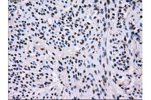 Image no. 2 for anti-L1 Cell Adhesion Molecule (L1CAM) antibody (ABIN1499084) (L1CAM anticorps)