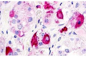 Image no. 1 for anti-G Protein-Coupled Receptor 12 (GPR12) (Extracellular Domain) antibody (ABIN1048701) (G Protein-Coupled Receptor 12 anticorps  (Extracellular Domain))