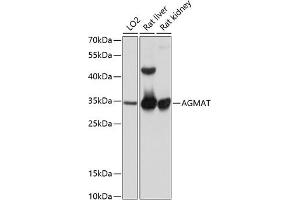 Western blot analysis of extracts of various cell lines, using AGMAT antibody (ABIN6131218, ABIN6136634, ABIN6136635 and ABIN6215786) at 1:1000 dilution. (AGMAT anticorps  (AA 1-352))