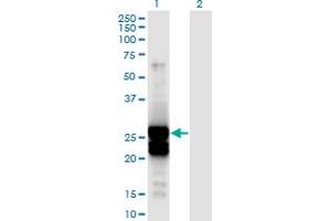 Western Blot analysis of APOBEC2 expression in transfected 293T cell line by APOBEC2 monoclonal antibody (M01), clone 4D7.