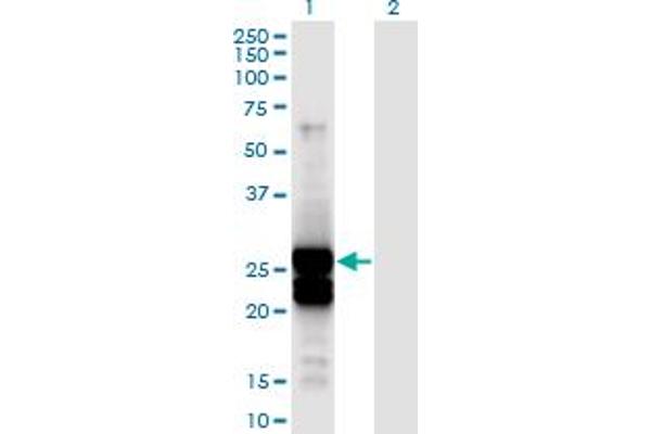 APOBEC2 Antikörper  (AA 1-224)