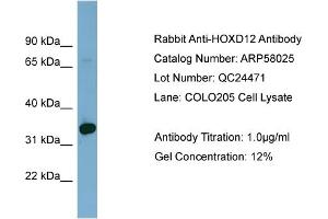 WB Suggested Anti-HOXD12  Antibody Titration: 0. (HOXD12 anticorps  (Middle Region))