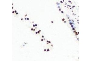 Immunohistochemical analysis of CGBP staining in mouse lung formalin fixed paraffin embedded tissue section.