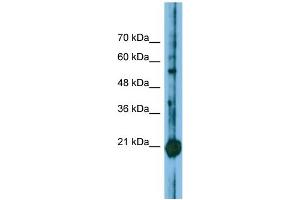Host: Rabbit Target Name: CBFB Sample Type: Jurkat Whole Cell lysates Antibody Dilution: 1. (CBFB anticorps  (N-Term))