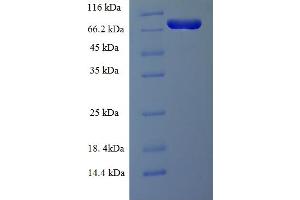 SDS-PAGE (SDS) image for Lymphocyte Cytosolic Protein 1 (LCP1) (AA 2-627) protein (His tag) (ABIN5713598)