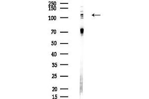 anti-Ubiquitin-Like Modifier Activating Enzyme 1 (UBA1) (Internal Region) antibody