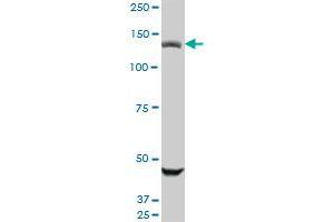 USP45 monoclonal antibody (M01), clone 1H2. (USP45 anticorps  (AA 106-196))