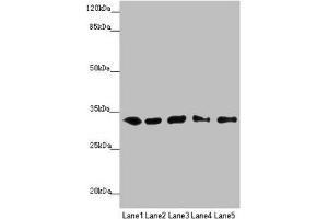 Western blot All lanes: MMACHC antibody at 5. (MMACHC anticorps  (AA 63-282))