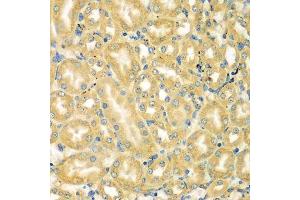 Immunohistochemistry of paraffin-embedded mouse kidney using MOCS3 antibody. (MOCS3 anticorps  (AA 271-460))