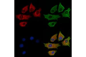 ABIN6264129 and ABIN6269164 staining HepG2 cells by IF/ICC.