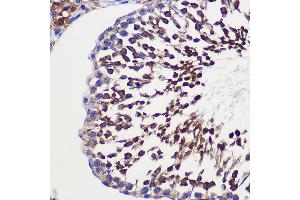 Immunohistochemistry of paraffin-embedded Rat testis using TUBGCP6 Rabbit pAb (ABIN7271055) at dilution of 1:100 (40x lens). (GCP6 anticorps  (AA 600-900))
