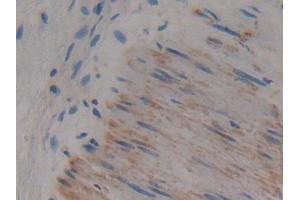 Detection of CAP2 in Human Stomach Tissue using Polyclonal Antibody to Adenylyl Cyclase Associated Protein 2 (CAP2)
