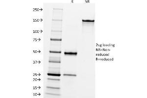 SDS-PAGE Analysis Purified CD10 Mouse Monoclonal Antibody (FR4D11). (MME anticorps)
