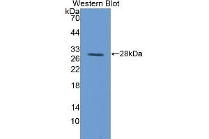 Detection of Recombinant TFR, Pig using Polyclonal Antibody to Transferrin Receptor (TFR) (Transferrin Receptor anticorps  (AA 578-765))