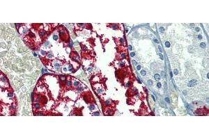 Immunohistochemistry with Human kidney lysate tissue