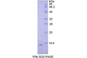 SDS-PAGE analysis of Human Cadherin, Neuronal Protein. (N-Cadherin Protéine)