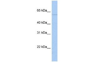 WB Suggested Anti-PAPD4 Antibody Titration:  0. (PAPD4 anticorps  (N-Term))