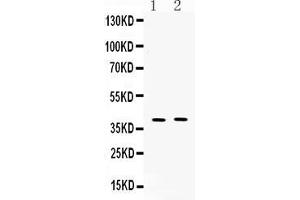 Western blot analysis of MC3 Receptor expression in mouse kidney extract ( Lane 1), and COLO320 whole cell lysates ( Lane 2). (MC3R anticorps  (N-Term))
