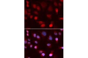 Immunofluorescence analysis of U2OS cells using ATP7B antibody. (ATP7B anticorps)