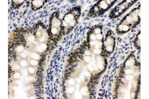 Anti- OGT Picoband antibody,IHC(P) IHC(P): Rat Intestine Tissue (OGT anticorps  (C-Term))