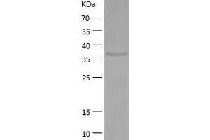 Western Blotting (WB) image for Protein Phosphatase Methylesterase 1 (PPME1) (AA 1-386) protein (His-IF2DI Tag) (ABIN7124673)