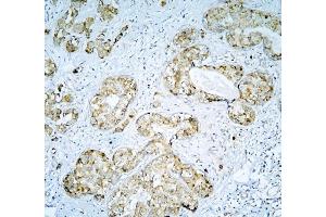 IHC analysis of DARS2 using anti-DARS2 antibody (ABIN6719279). (DARS2 anticorps  (AA 334-448))