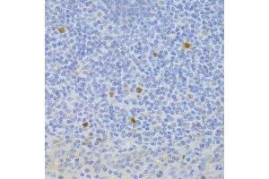 Immunohistochemistry of paraffin-embedded human tonsil using FCN1 Antibody.