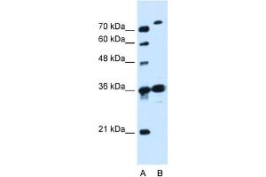 WB Suggested Anti-SLC9A7 Antibody Titration:  0. (NHE7 anticorps  (N-Term))