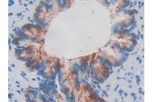 Detection of RNASE3 in Rat Lung Tissue using Polyclonal Antibody to Ribonuclease A3 (RNASE3)