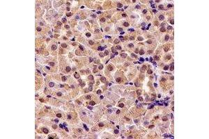 Immunohistochemical analysis of HS1BP3 staining in rat kidney formalin fixed paraffin embedded tissue section. (HS1BP3 anticorps)