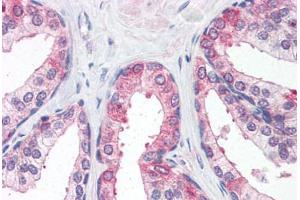Human Prostate (formalin-fixed, paraffin-embedded) stained with CLDN5 antibody ABIN364455 at 15 ug/ml followed by biotinylated goat anti-rabbit IgG secondary antibody ABIN481713, alkaline phosphatase-streptavidin and chromogen. (Claudin 5 anticorps  (C-Term))