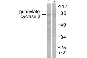 Western Blotting (WB) image for anti-Guanylate Cyclase, beta (GUCYB) (N-Term) antibody (ABIN1848590) (GUCYB anticorps  (N-Term))