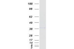 Validation with Western Blot