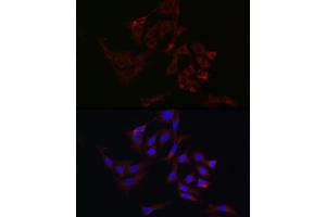 Immunofluorescence analysis of A-549 cells using  Rabbit pAb (ABIN3021090, ABIN3021091, ABIN3021092 and ABIN6213948) at dilution of 1:100 (40x lens).