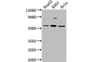 Western Blot Positive WB detected in: HepG2 whole cell lysate, K562 whole cell lysate, Hela whole cell lysate All lanes: ADRA1A antibody at 1:2000 Secondary Goat polyclonal to rabbit IgG at 1/50000 dilution Predicted band size: 52, 53, 48, 51, 33, 38, 36, 41 kDa Observed band size: 52 kDa (alpha 1 Adrenergic Receptor anticorps  (AA 6-22))