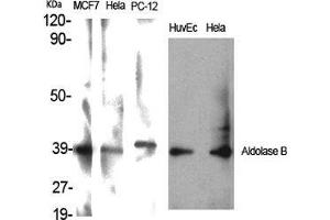 Western Blot (WB) analysis of specific cells using Aldolase B Polyclonal Antibody.