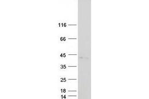 Validation with Western Blot