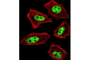 Fluorescent image of  cells stained with IL18 Antibody (C-term) . (IL-18 anticorps  (C-Term))