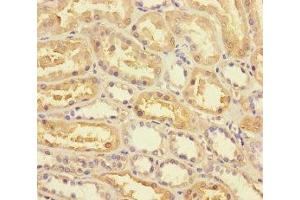 Immunohistochemistry of paraffin-embedded human kidney tissue using ABIN7163422 at dilution of 1:100 (ANKRD33 anticorps  (AA 1-272))