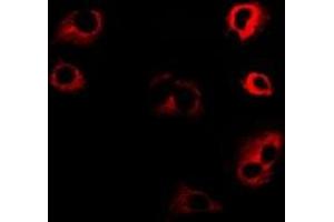 Immunofluorescent analysis of Kinesin 2 staining in SW480 cells.