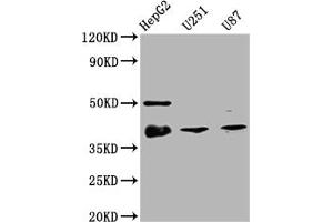 Western Blot Positive WB detected in: HepG2 whole cell lysate, U251 whole cell lysate, U87 whole cell lysate All lanes: TTF1 antibody at 1:2000 Secondary Goat polyclonal to rabbit IgG at 1/50000 dilution Predicted band size: 39 kDa Observed band size: 39 kDa