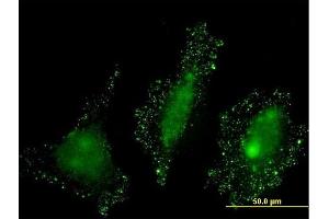 Immunofluorescence of monoclonal antibody to PKN2 on HeLa cell.