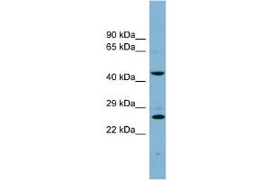 WB Suggested Anti-VPS28 Antibody Titration: 0. (VPS28 anticorps  (N-Term))