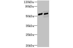 Western blot All lanes: FAM124B antibody at 12 μg/mL Lane 1: Hela whole cell lysate Lane 2: K562 whole cell lysate Secondary Goat polyclonal to rabbit IgG at 1/10000 dilution Predicted band size: 51, 32 kDa Observed band size: 51 kDa (FAM124B anticorps  (AA 146-272))