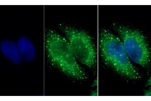 Detection of HADH in Human HepG2 cell using Polyclonal Antibody to Hydroxyacyl Coenzyme A Dehydrogenase (HADH) (HADH anticorps  (AA 1-236))