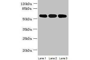 Western blot All lanes: STK33 antibody at 4 μg/mL Lane 1: Mouse kidney tissue Lane 2: Hela whole cell lysate Lane 3: Jurkat whole cell lysate Secondary Goat polyclonal to rabbit IgG at 1/10000 dilution Predicted band size: 58, 51 kDa Observed band size: 58 kDa (STK33 anticorps  (AA 231-514))